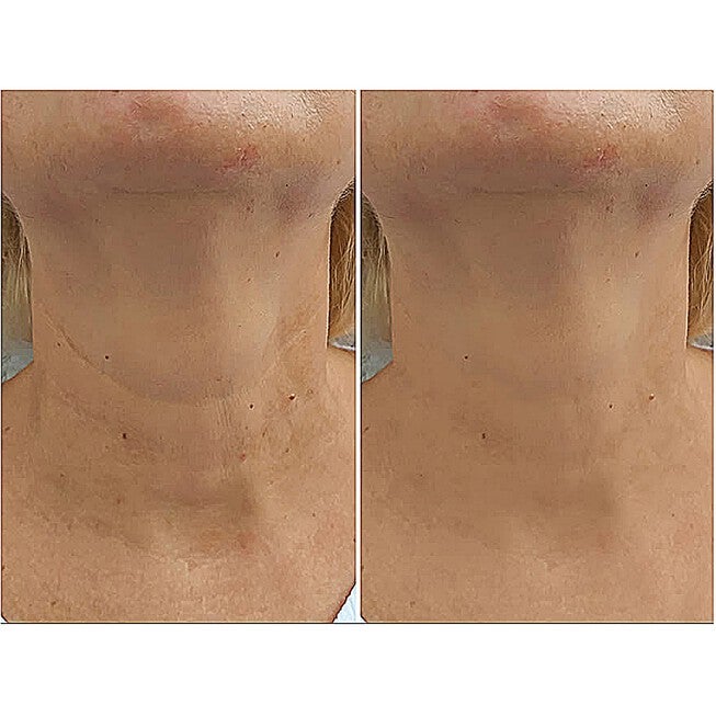 30 Second Lift Beauty Tools, , alternate image number null