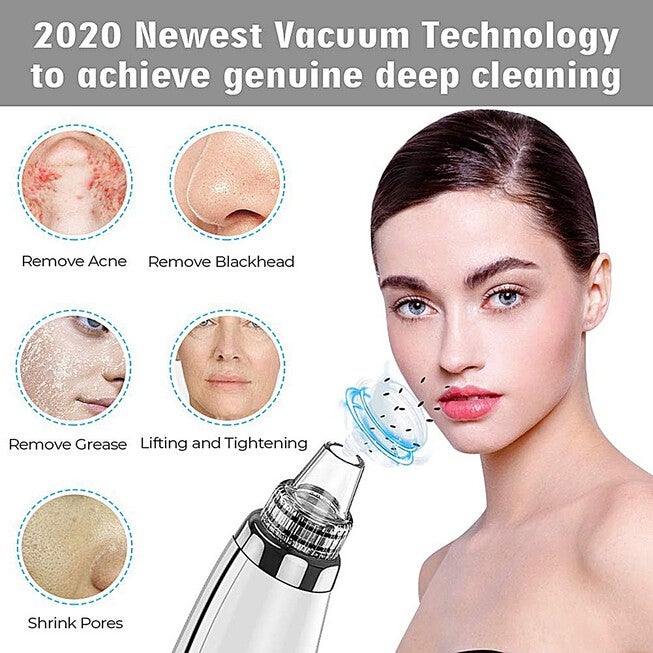 Vacuum Pressure Suction Pore Cleanser Beauty Tools, , alternate image number null