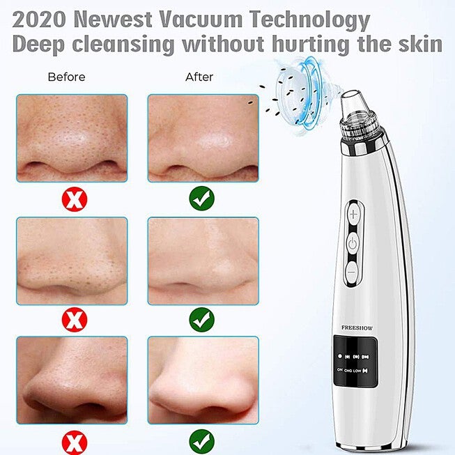 Vacuum Pressure Suction Pore Cleanser Beauty Tools, , alternate image number null