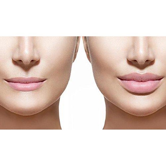 Vacuum Suction Lip Suction Beauty Tools, , on-hover image number null