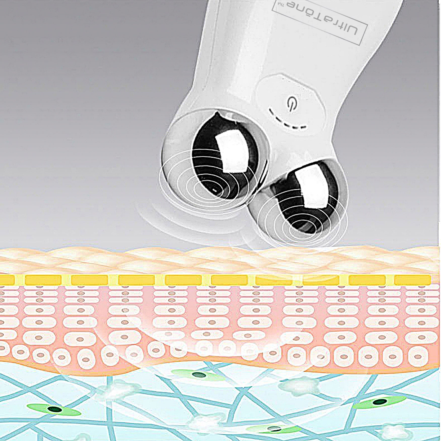 IGIA Ultra Tone Face & Body Microcurrent Toning and Sculpting image number 2